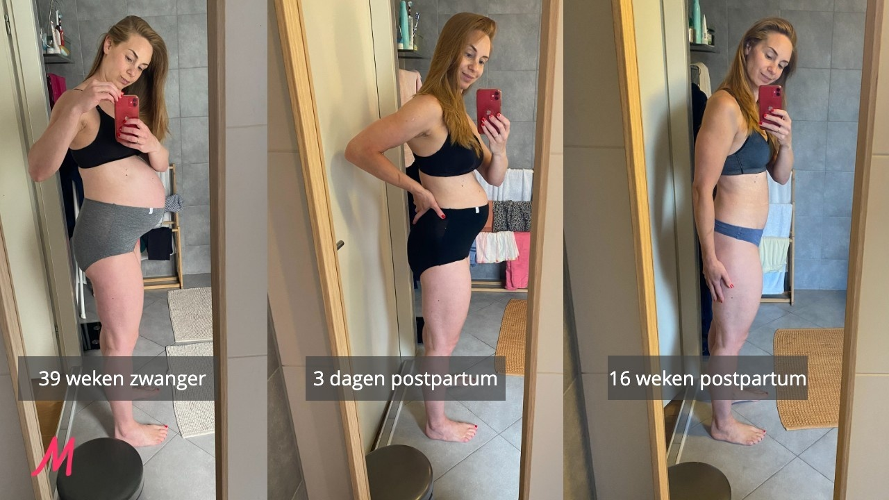 Gezond en verantwoord afvallen na de bevalling met medische begeleiding